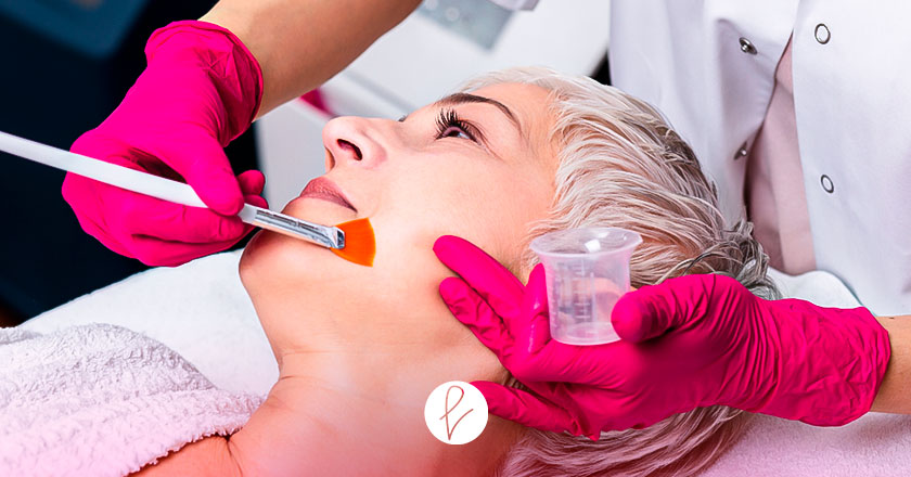 Peeling Facial Químico